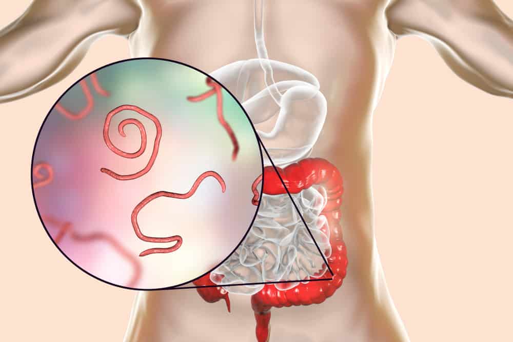 dấu hiệu nhiễm giun sán ở người lớn