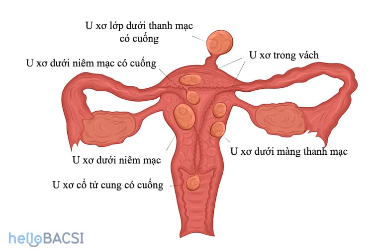 đau khi quan hệ tình dục