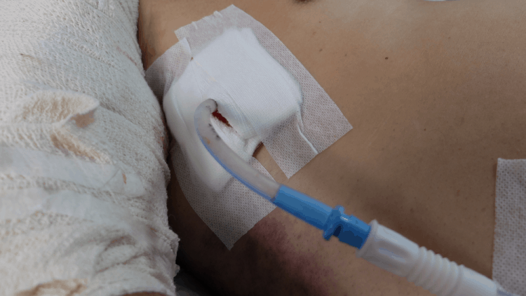 đau ngực khi hít thở sâu